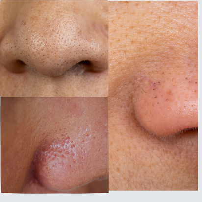 Maschera la nota di collagene - MNUANCE