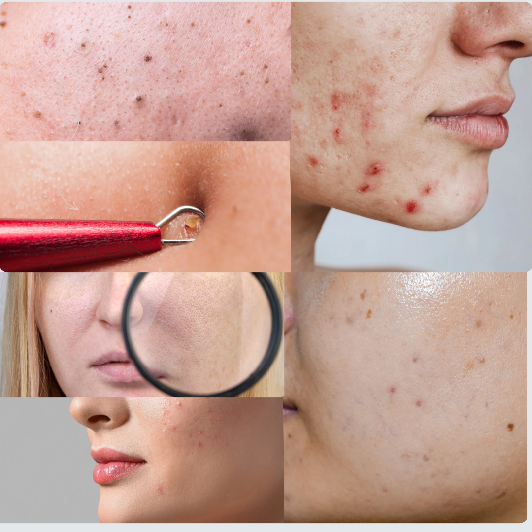 Maschera la nota di collagene - MNUANCE